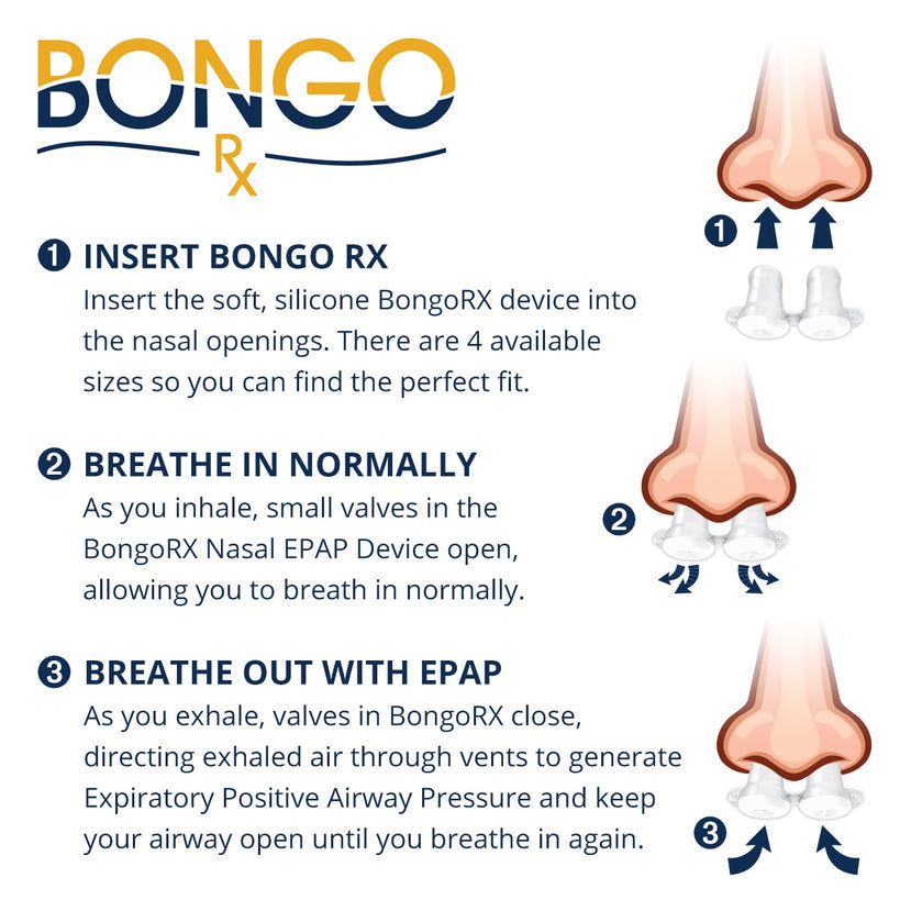 AirAvant Medical Bongo Rx EPAP Starter Kit For Sleep Apnea